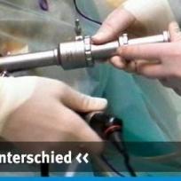 laparoscopic assisted surgery