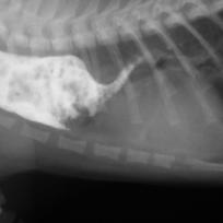 persistierender rechter Aortenbogen