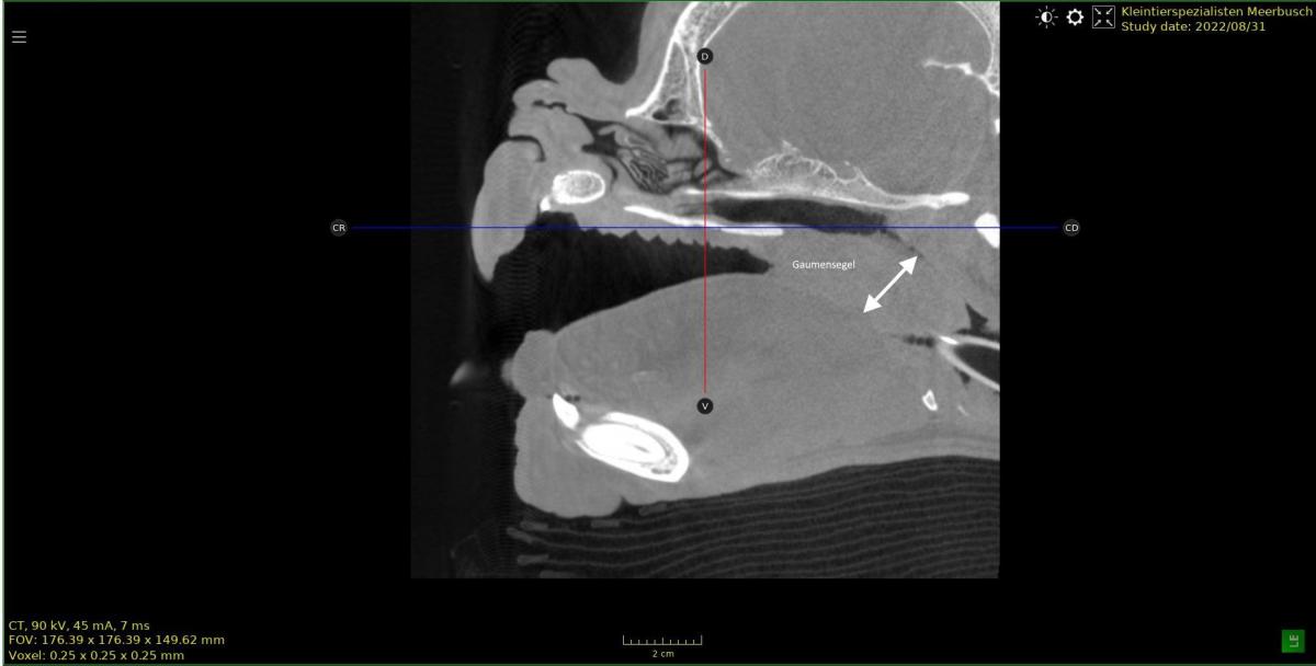 CT einer französischen Bulldogge. Das Gaumensegel ist nicht nur zu lang, ein ebenso großes Problem ist die Dicke des Gaumensegels, welches den Nasopharynx, den Nasenrachenraum verlegt.
